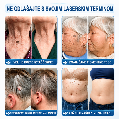🔥 HISKIN® Roll-on za ciljno nego kože Posebna ponudba: dodatnih 30% popusta