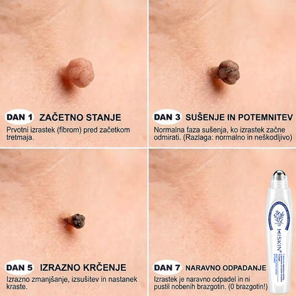 🔥 HISKIN® Roll-on za ciljno nego kože Posebna ponudba: dodatnih 30% popusta