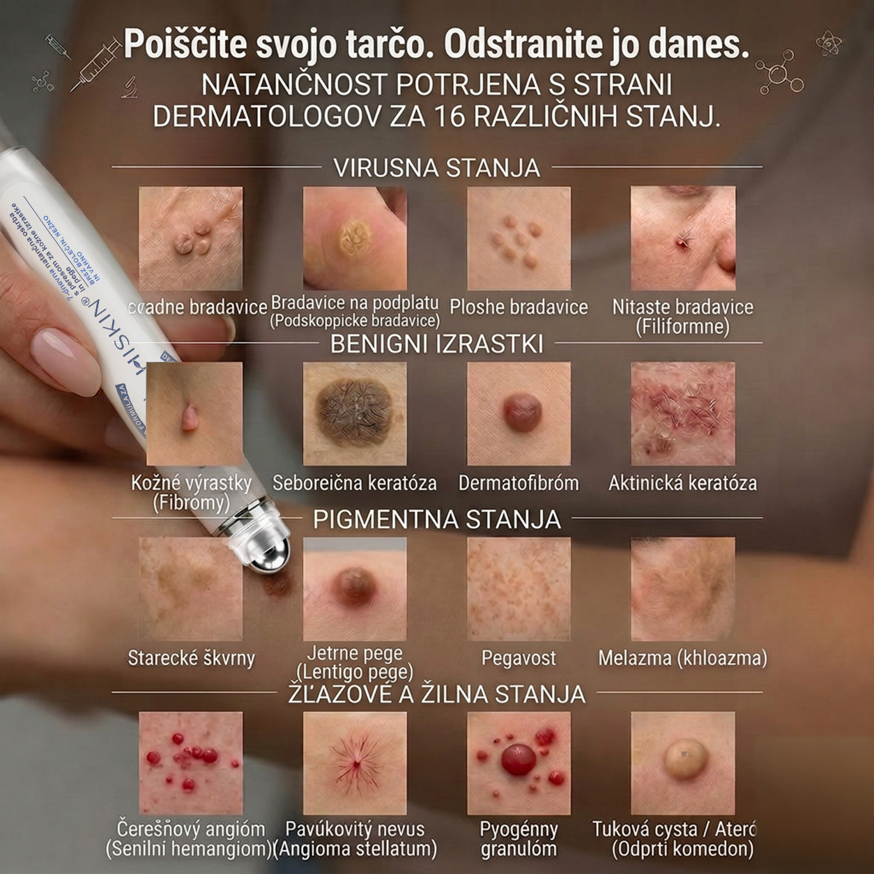🔥 HISKIN® Roll-on za ciljno nego kože Posebna ponudba: dodatnih 30% popusta
